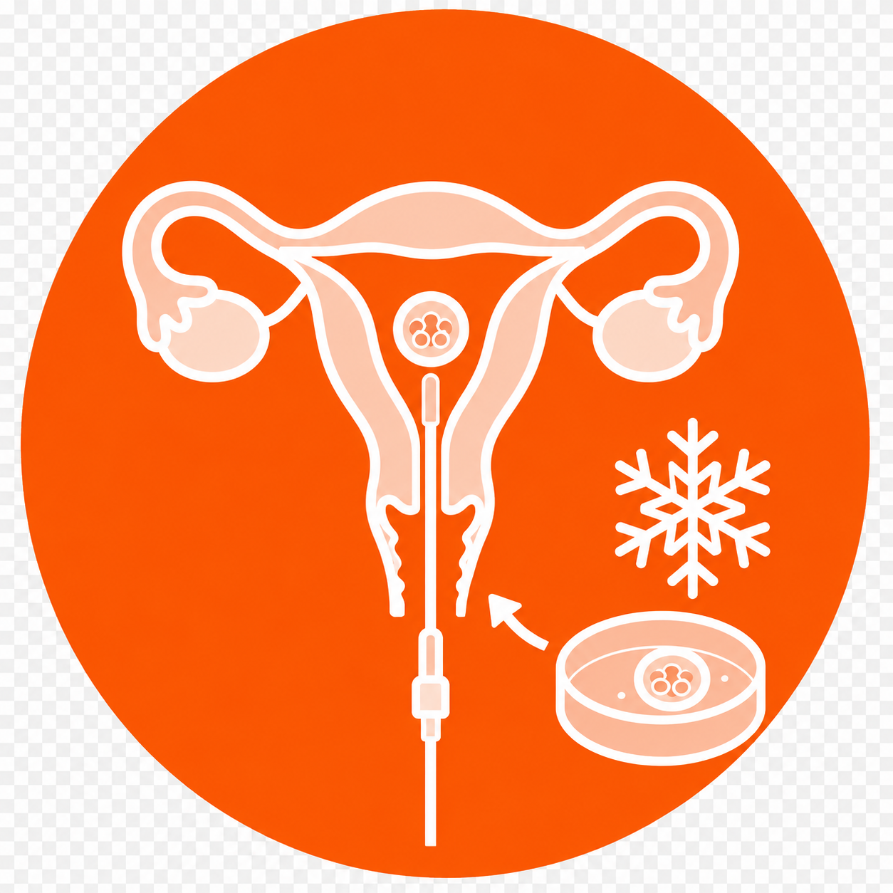 Frozen Embryo Transfer
