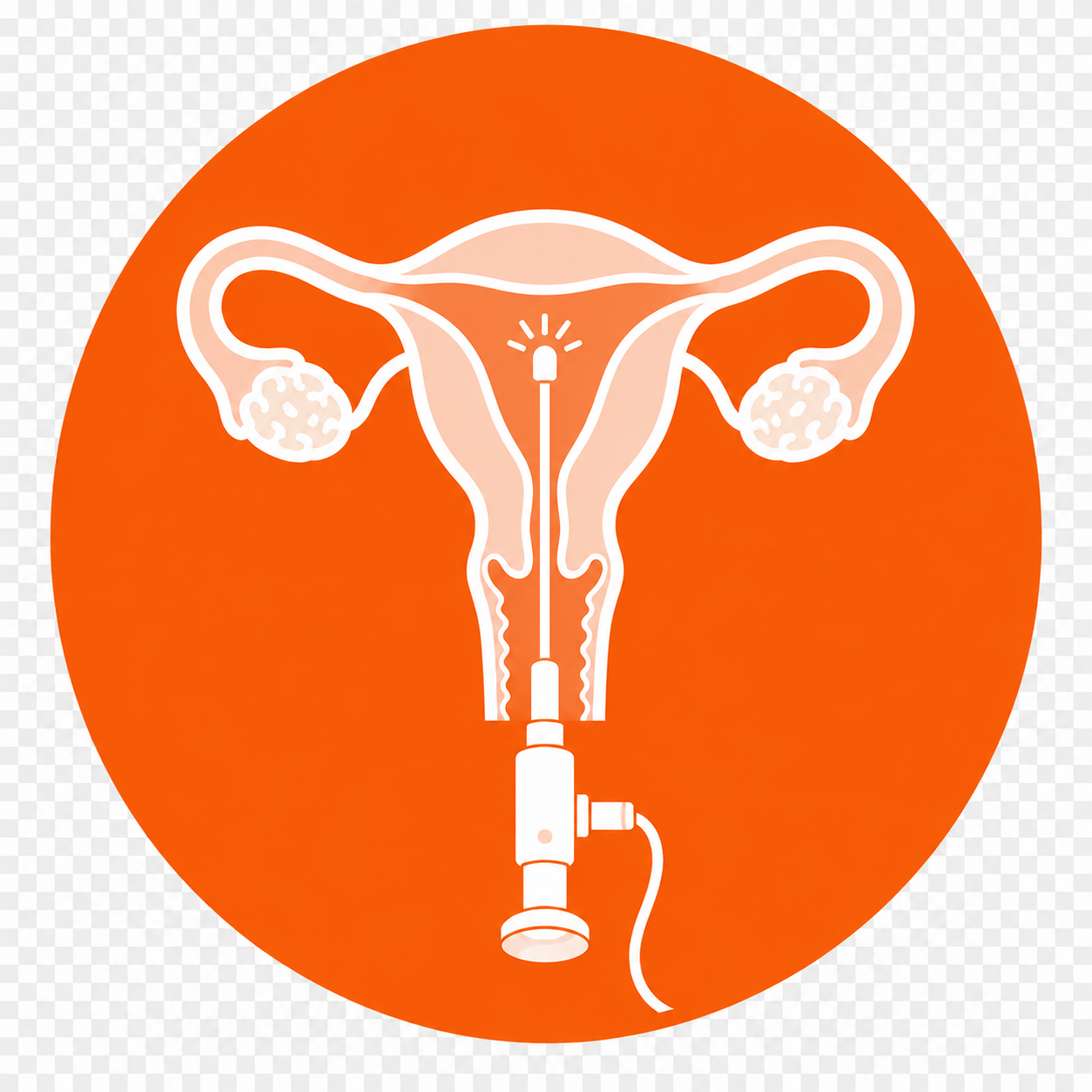 Hysteroscopy
