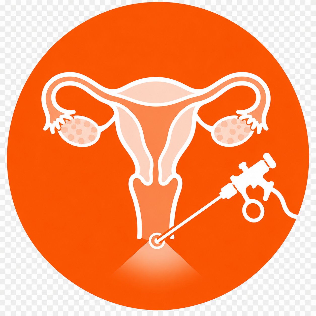 Laparoscopy