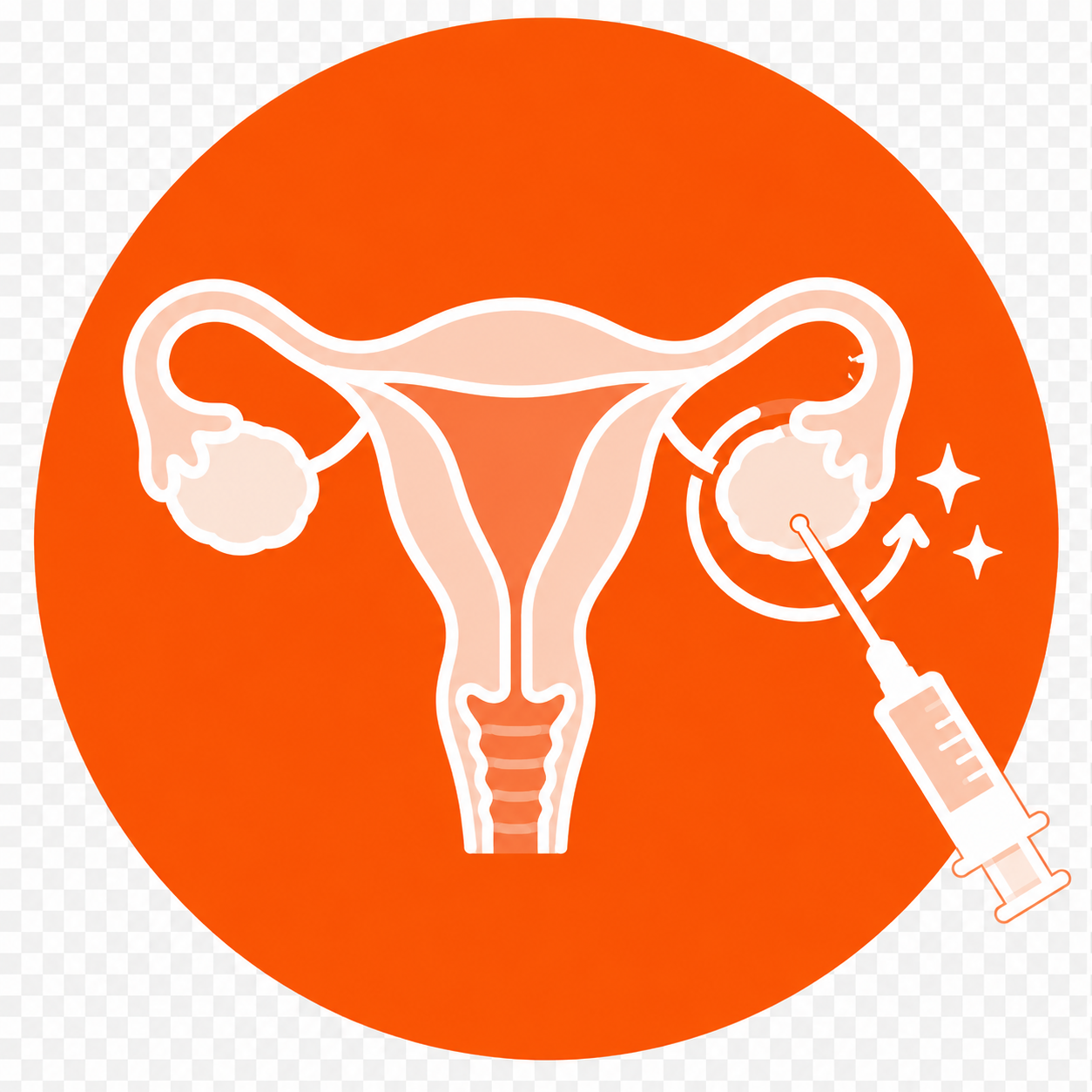 Ovarian Rejuvenation