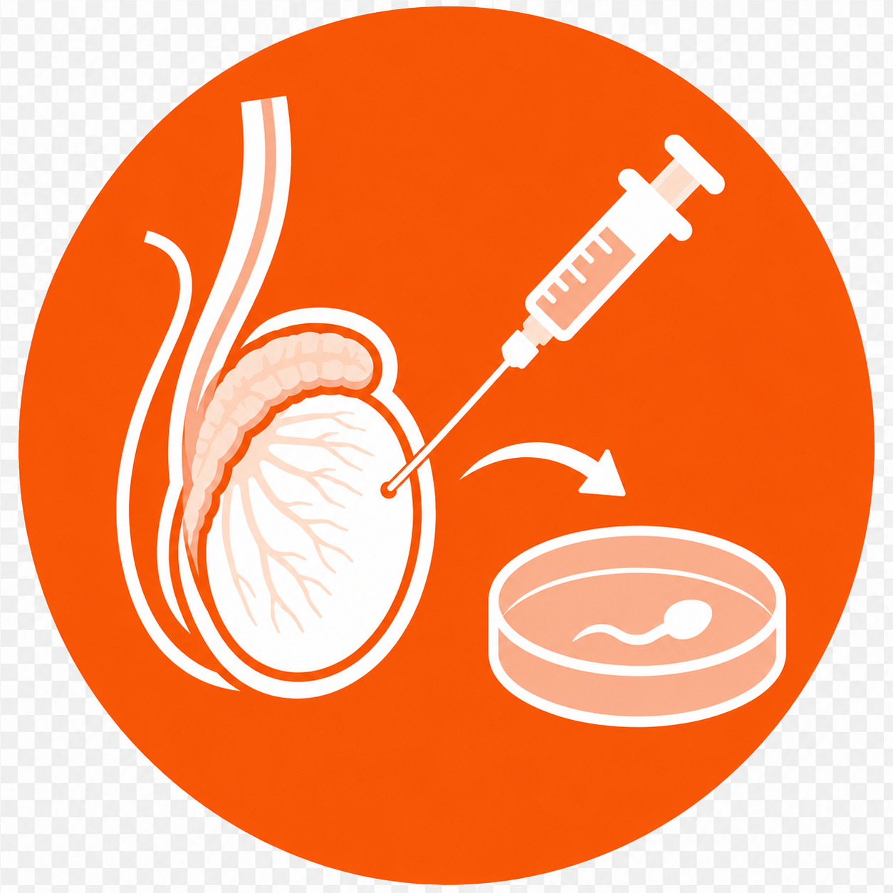 Sperm Retrieval PESA TESA MESA